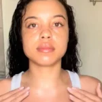 woman_pateint_782365